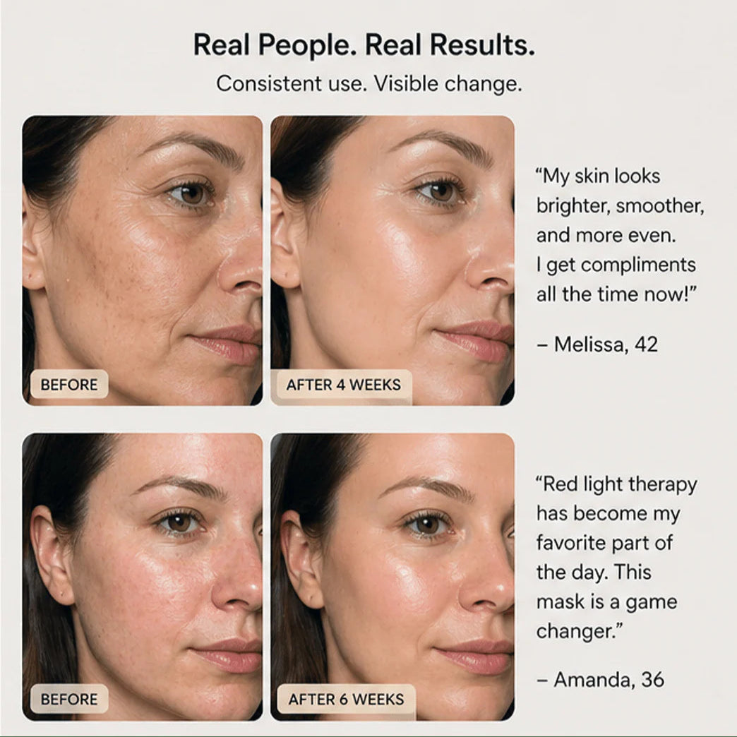 ™ LED Red Light Therapy Face Mask